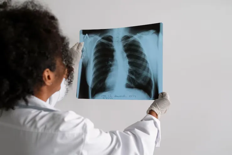 coding pneumonia - Cadence Collaborative