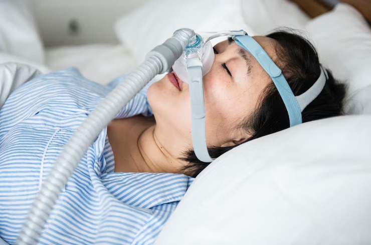 ICD-10 Coding for CPAP in Sleep Apnea